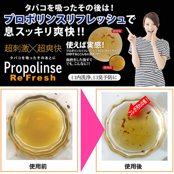 �v���|�����X���t���b�V���@�i�P�T�O�����j