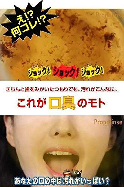 �v���|�����X�@�U�O�O�����@�i�����j